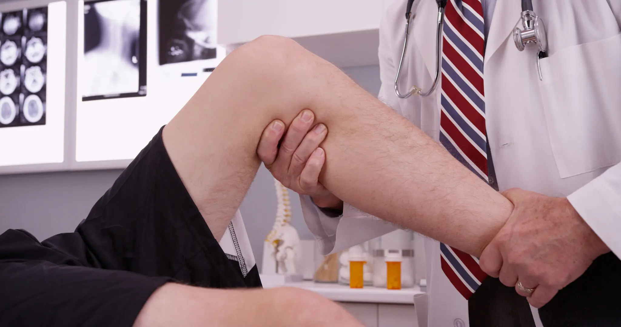 Knee Injuries AdobeStock 104436266 scaled