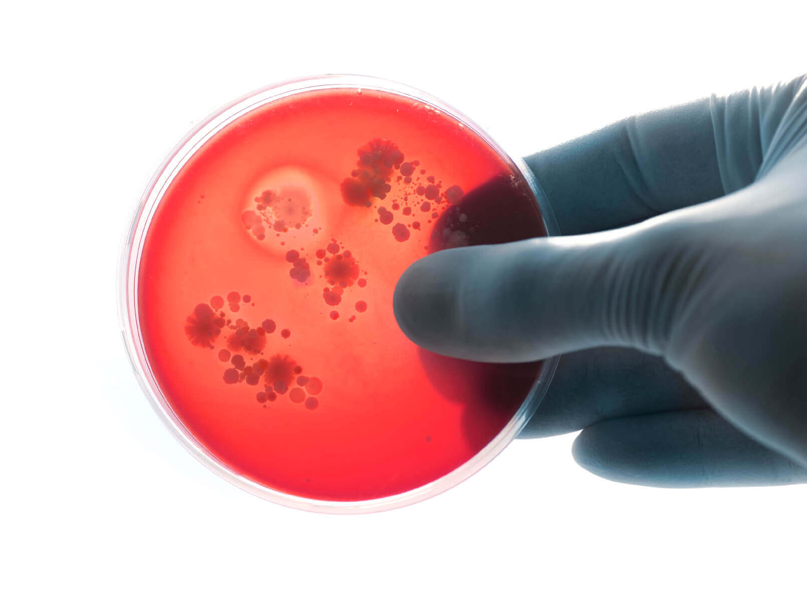 Gloved hands holding a bacteria plate