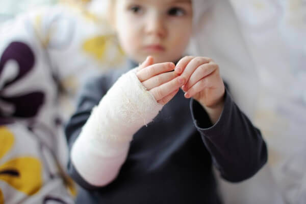 Child with cast on arm