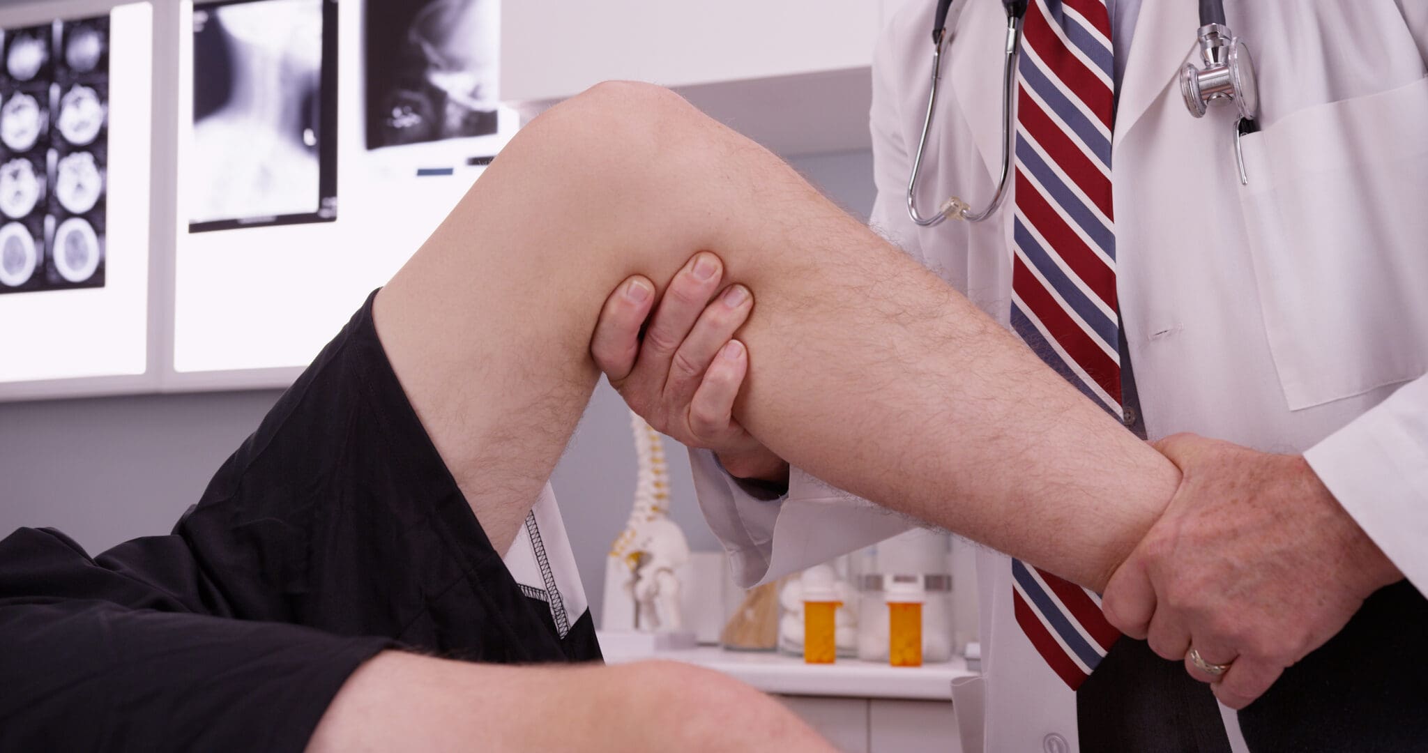 Knee Injuries AdobeStock 104436266 scaled