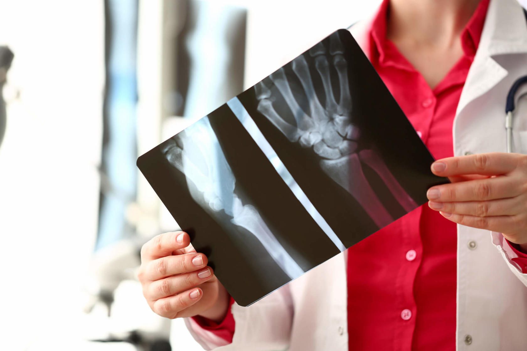 fracture and soft tissue injury lawyers
